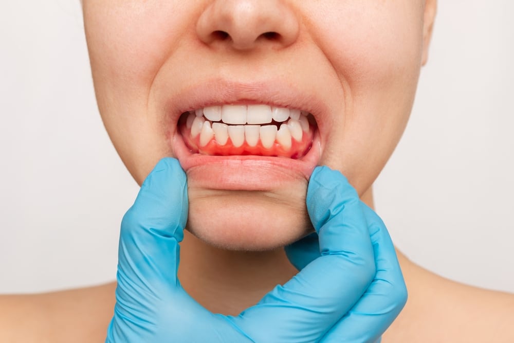 A dentist examining a woman's teeth and gums for oral pathologies